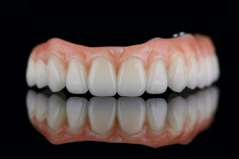 Image showcasing a before-and-after smile transformation with All-on-4 dental implants. The "before" side shows missing or damaged teeth, while the "after" side displays a complete, natural-looking set of teeth. Text on the image says "All-On-4 Dental Implants: Transform Your Smile".