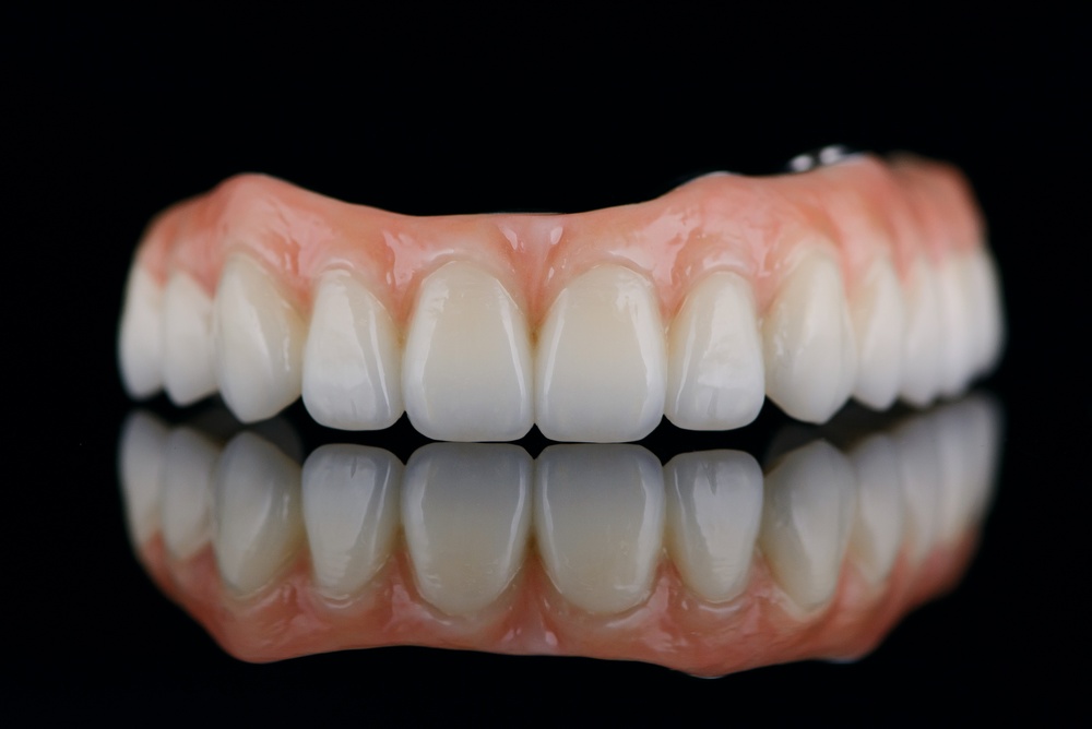 Image showcasing a before-and-after smile transformation with All-on-4 dental implants. The "before" side shows missing or damaged teeth, while the "after" side displays a complete, natural-looking set of teeth. Text on the image says "All-On-4 Dental Implants: Transform Your Smile".